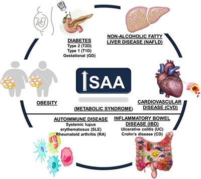 Serum amyloid A and metabolic disease: evidence for a critical role in chronic inflammatory conditions